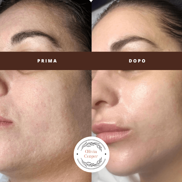 Trattamento viso Olivia Cooper illuminante