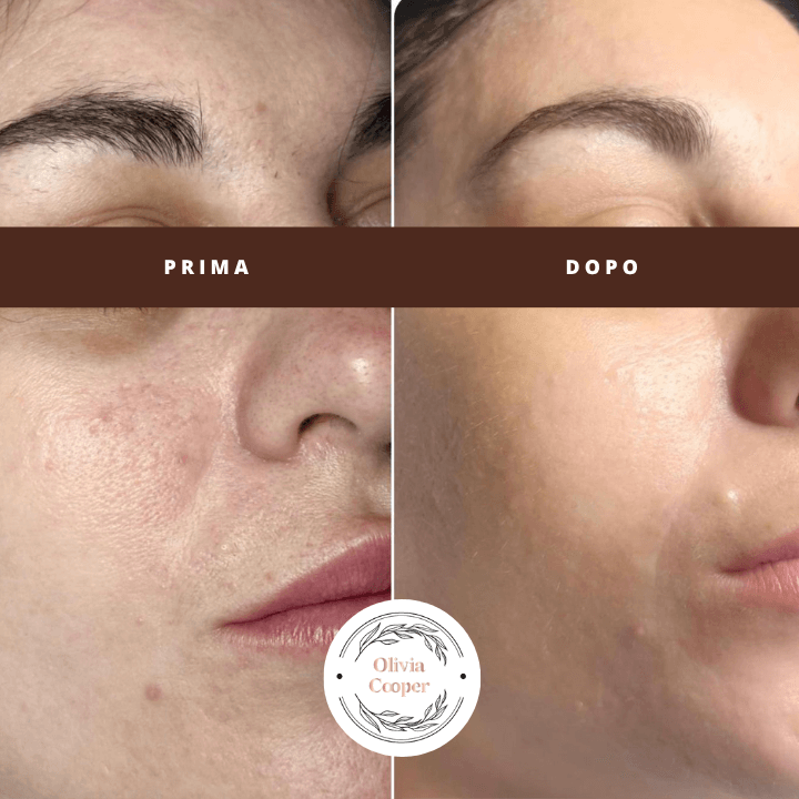 Massaggi viso antietà