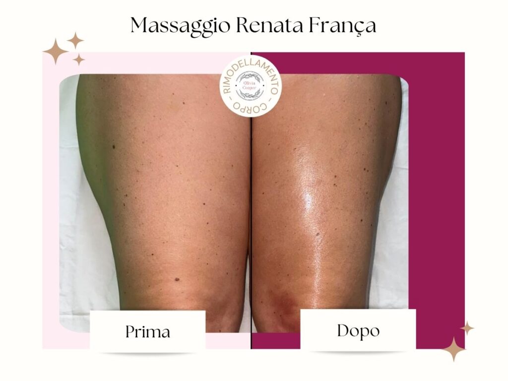 Gambe trattate con il Metodo Renata Franca da Olivia Cooper Ciampino