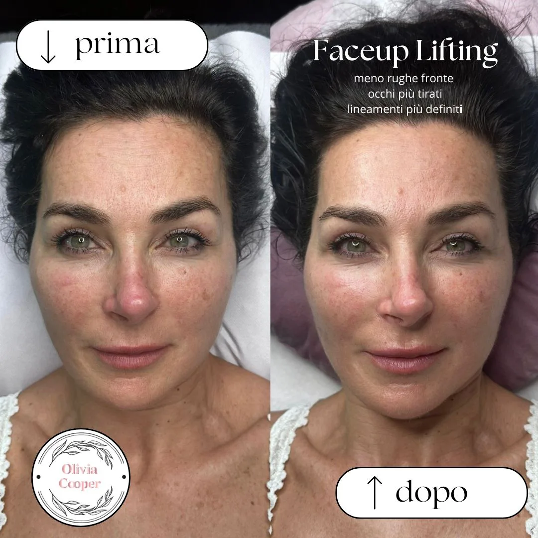 prima e dopo massaggio viso lifting "FaceUp" Olivia Cooper Roma Ciampino